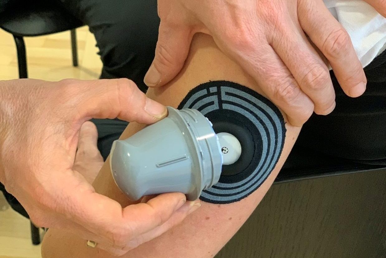 Entwicklung von unserem SMP+ – Zaubertrank